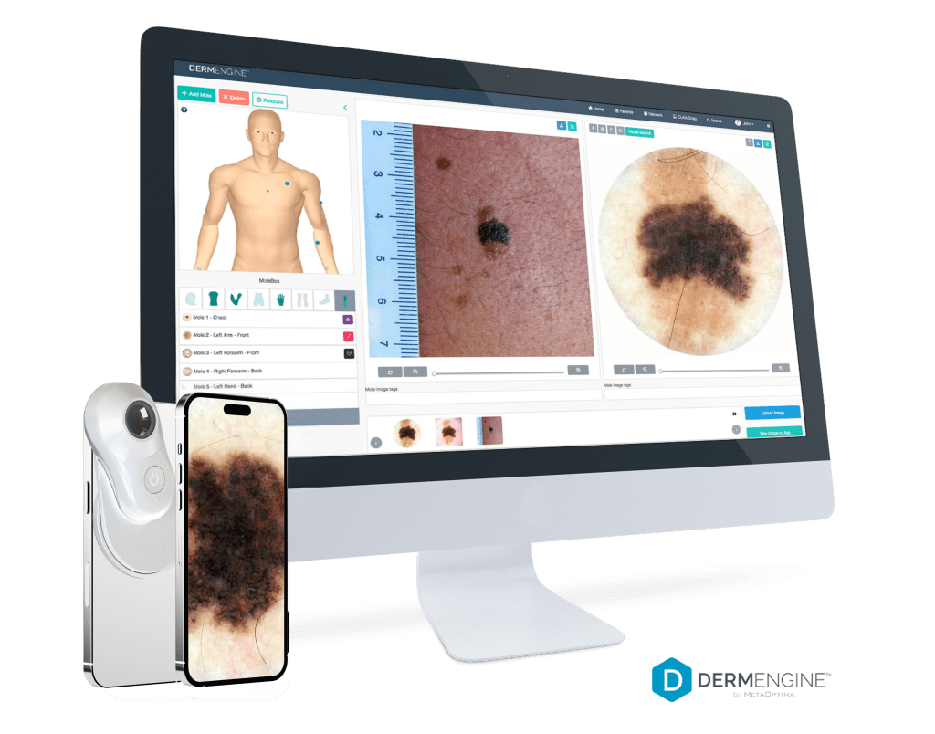 Medtech ALEX partner DermEngine on a computer and phone