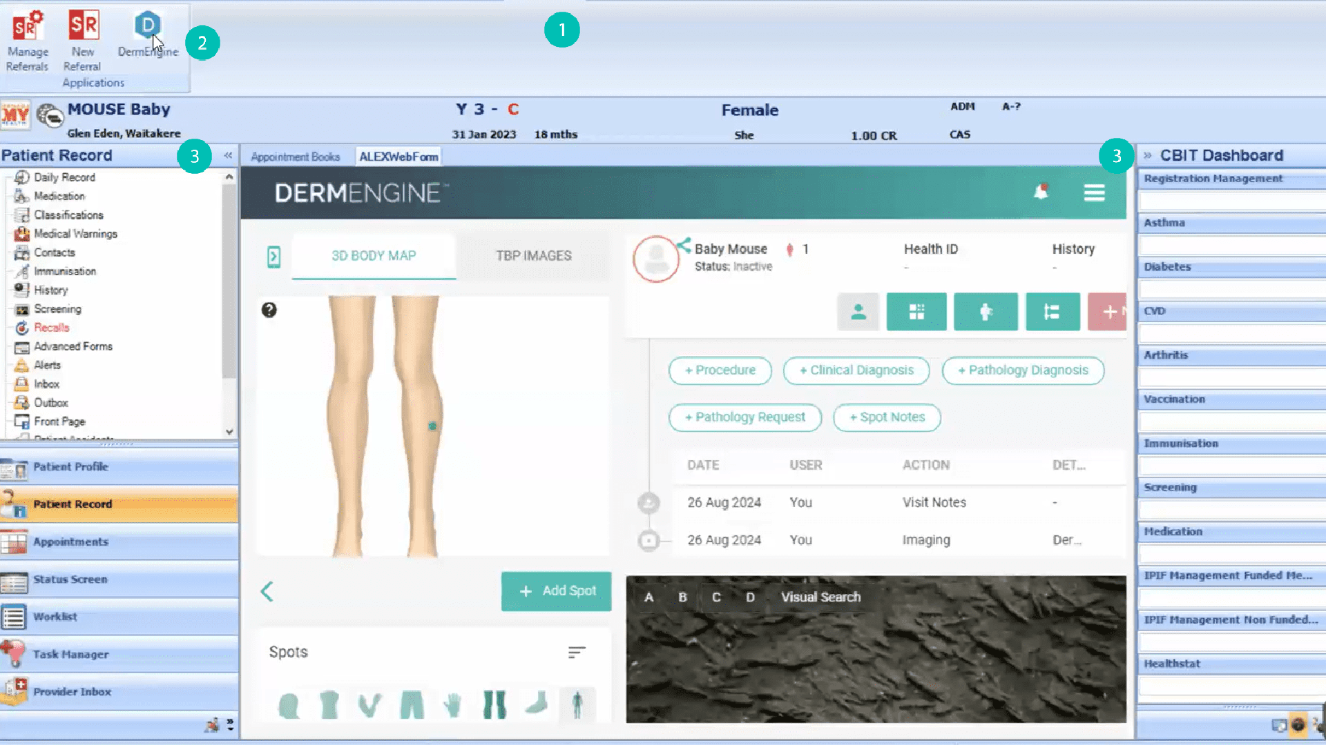 Medtech Evolution and DermEngine integrated via Medtech ALEX