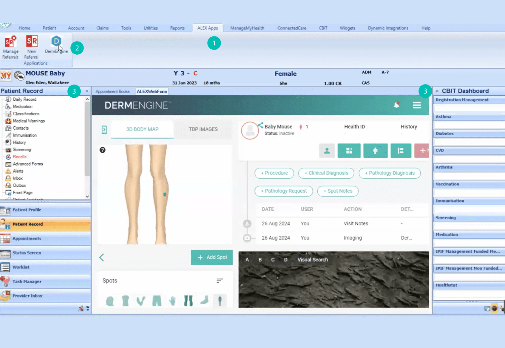 Medtech Evolution and DermEngine integrated via Medtech ALEX